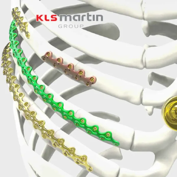 Sistema de Osteosínstesis L1® Rib Plating KLS Martin Group