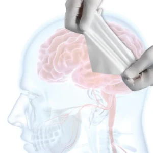 DuraMatrix Membrana de Colágeno Purificado